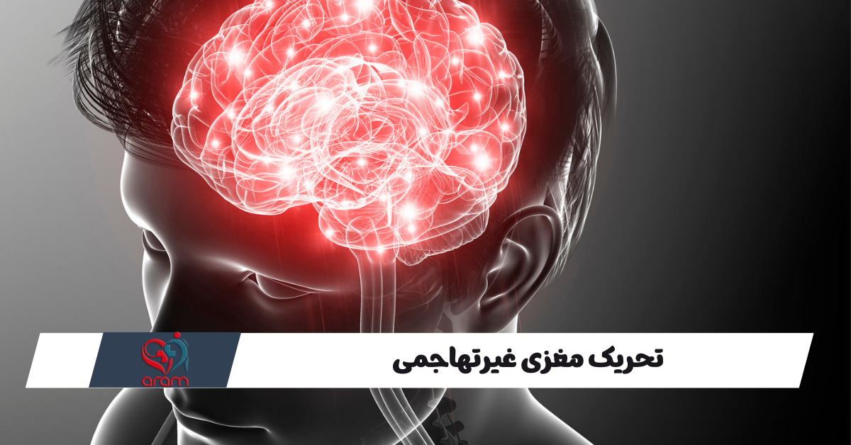 تحریک مغزی غیرتهاجمی