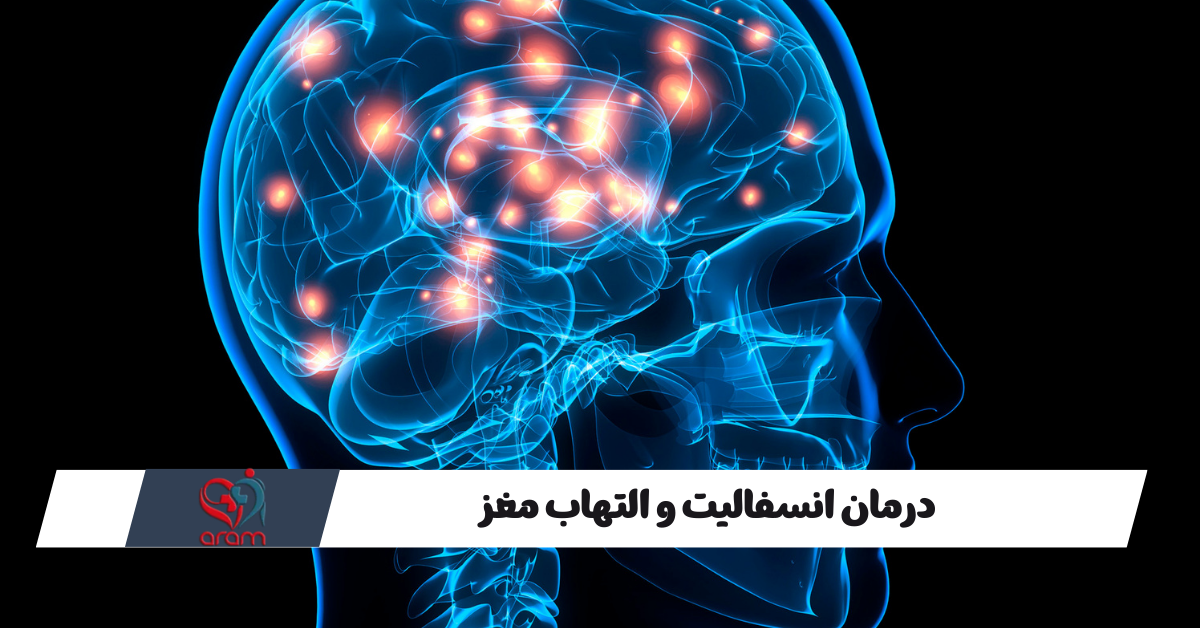 درمان انسفالیت و التهاب مغز