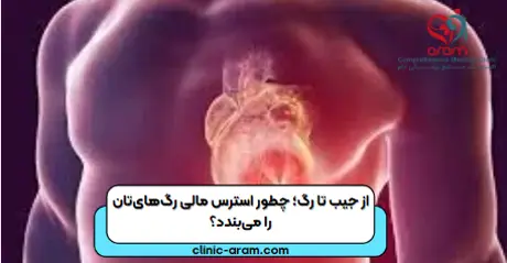 از جیب تا رگ