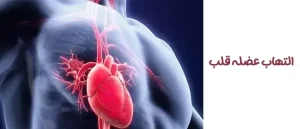 التهاب عضله قلب