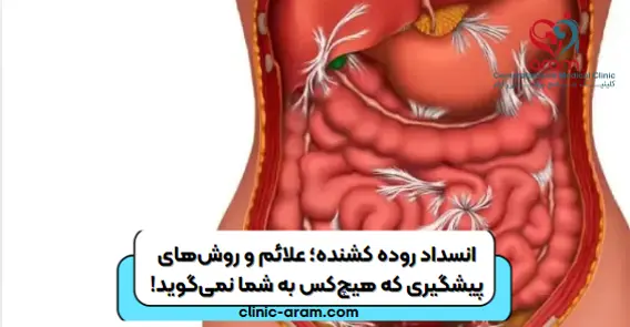 انسداد روده