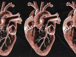 بلوک مادرزادی قلب