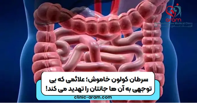 سرطان کولون