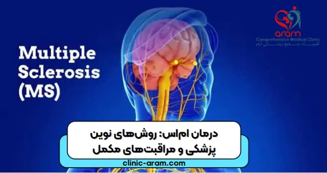 بیماری ام اس