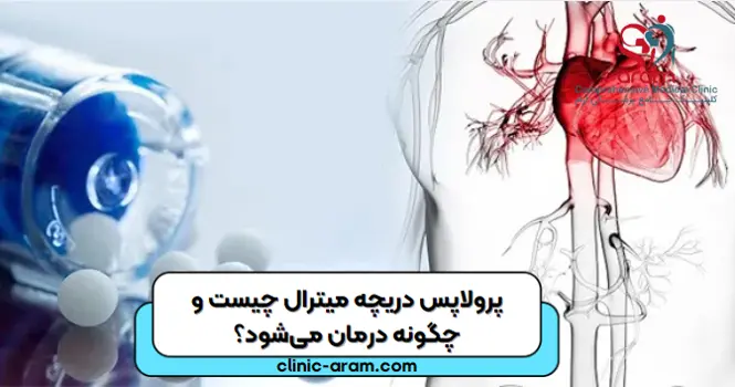 افتادگی دریچه میترال