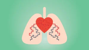 فشار خون ریوی