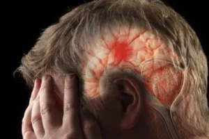 لخته خون در مغز