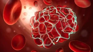 لخته خون در مغز