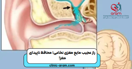 مایع مغزی