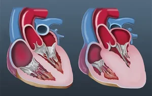 کادیومپاتی